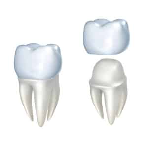 dental crowns 300x286 1