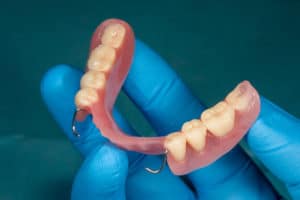 A hand wearing a rubber glove holds a partial denture.