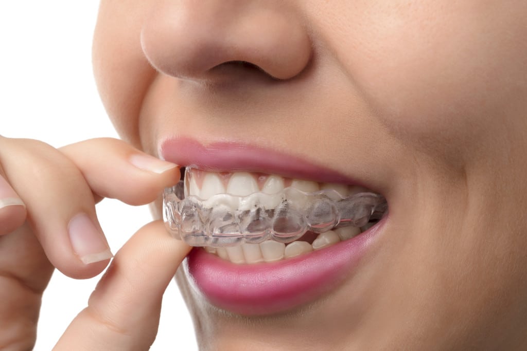 Invisalign Highland Park NJ