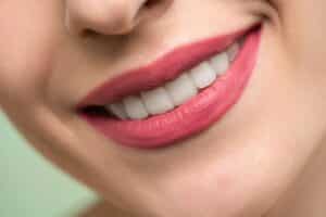 Dental implants (2)