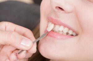 A close-up of a dental professional holding a veneer next to a patient’s teeth during a shade-matching process