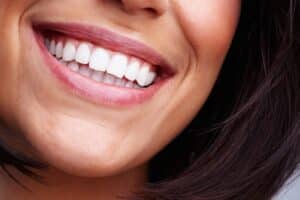 Woman with beautiful smile after getting veneers.