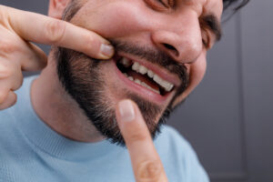 Close-up of a man with a missing tooth, in danger of lasting effects like shifting teeth, bite changes, or jawbone loss.